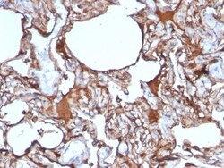 MCAM/CD146 Antibody (SPM620), Novus Biologicals 0.2mg; Unlabeled:Antibodies,